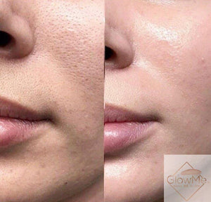 BB Glow Models Registration - ONLY $99 REGULAR PRICE $299